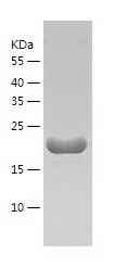 Recombinant Human CRYGS