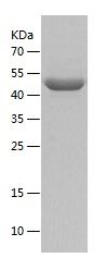Recombinant Human IL-5RA