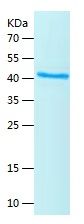 Recombinant Human B4GALT6