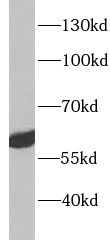 ACVRL1 antibody