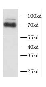 SPDL1 antibody
