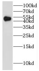 IRF5 antibody