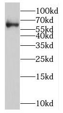 NOVA2 antibody