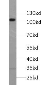 RASA1 antibody
