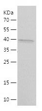 Recombinant Human NKX2-5
