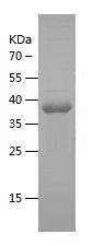 Recombinant Human NBL1
