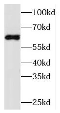PIP5K1B antibody