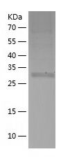 Recombinant Human BNIP1