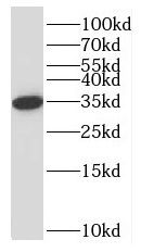 NPL antibody