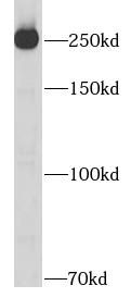 FN1 antibody