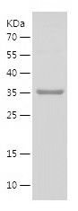 Recombinant Human VDAC3