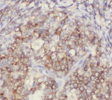 ITGAL antibody