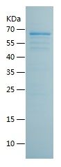 Recombinant Human G3BP1