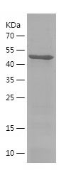 Recombinant Human GAS6