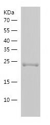 Recombinant Human LOX