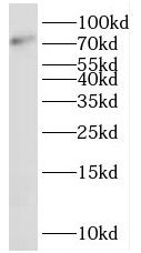 SHCBP1 antibody