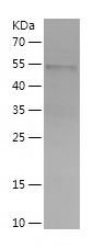 Recombinant Human FBLN5