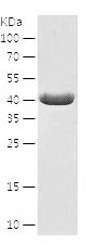 Recombinant Human CALCOCO2