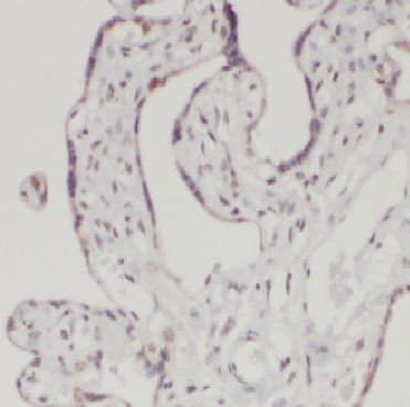 DAZAP1 antibody