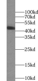 HLA-F antibody