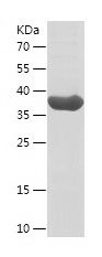 Recombinant Human TARBP2