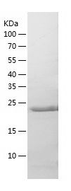 Recombinant Human PSMB3
