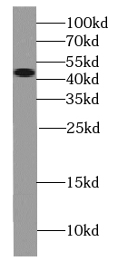 Pan-PAX antibody