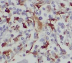 BAGE4 antibody