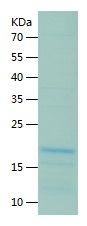 Recombinant Human EAF1