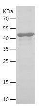 Recombinant Human LTBP1