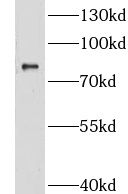 GRAMD1B antibody