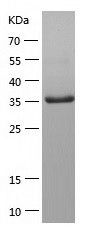 Recombinant Human TLNRD1