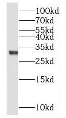 NRIP2 antibody