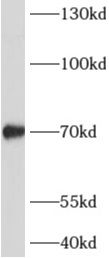 ADAMTSL4 antibody