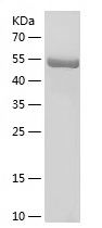 Recombinant Human KATNA1