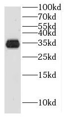 HUS1B antibody