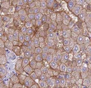 AMT antibody