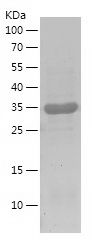 Recombinant Human BACE2