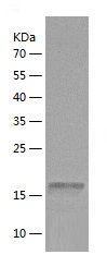 Recombinant Human TIGIT