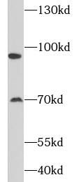SATB2 antibody