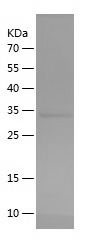 Recombinant Human NKX2-1