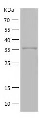 Recombinant Human GMPR