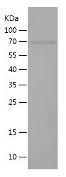 Recombinant Human DLL3