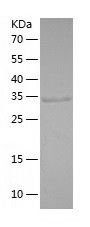 Recombinant Human GRHPR