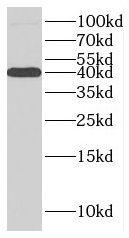 MACROH2A2 antibody