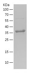 Recombinant Human MYH7