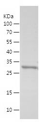 Recombinant Human FUS