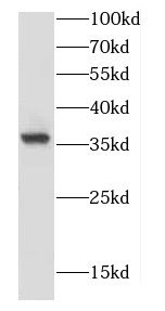 CAMLG antibody