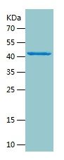 Recombinant Human ATP2A1