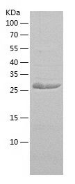 Recombinant Human PKP1